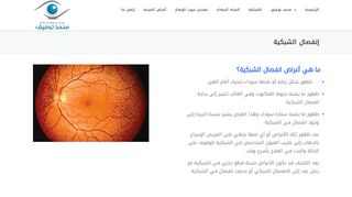 لقطة شاشة لموقع علاج انفصال الشبكية في مصر
بتاريخ 22/09/2019
بواسطة دليل مواقع الدليل